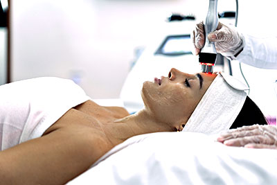 radio frequency facial