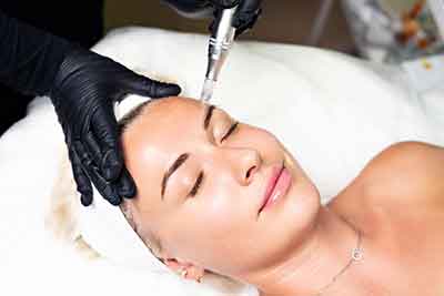 microneedling facial is a tried and tested method of restoring skin texture